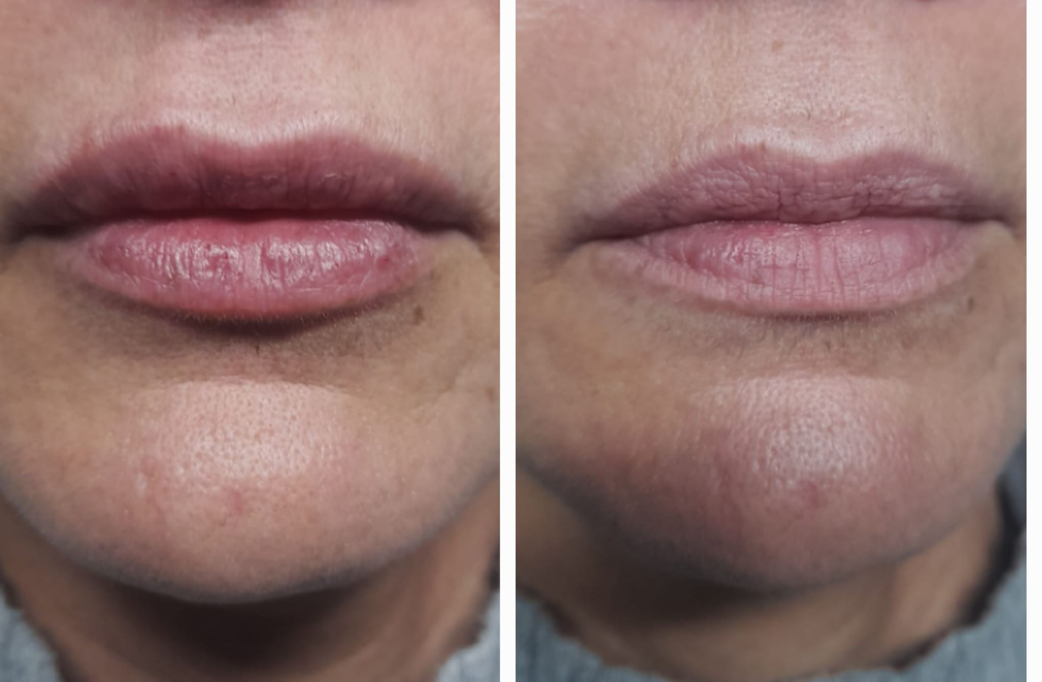 Diseño de Labios
