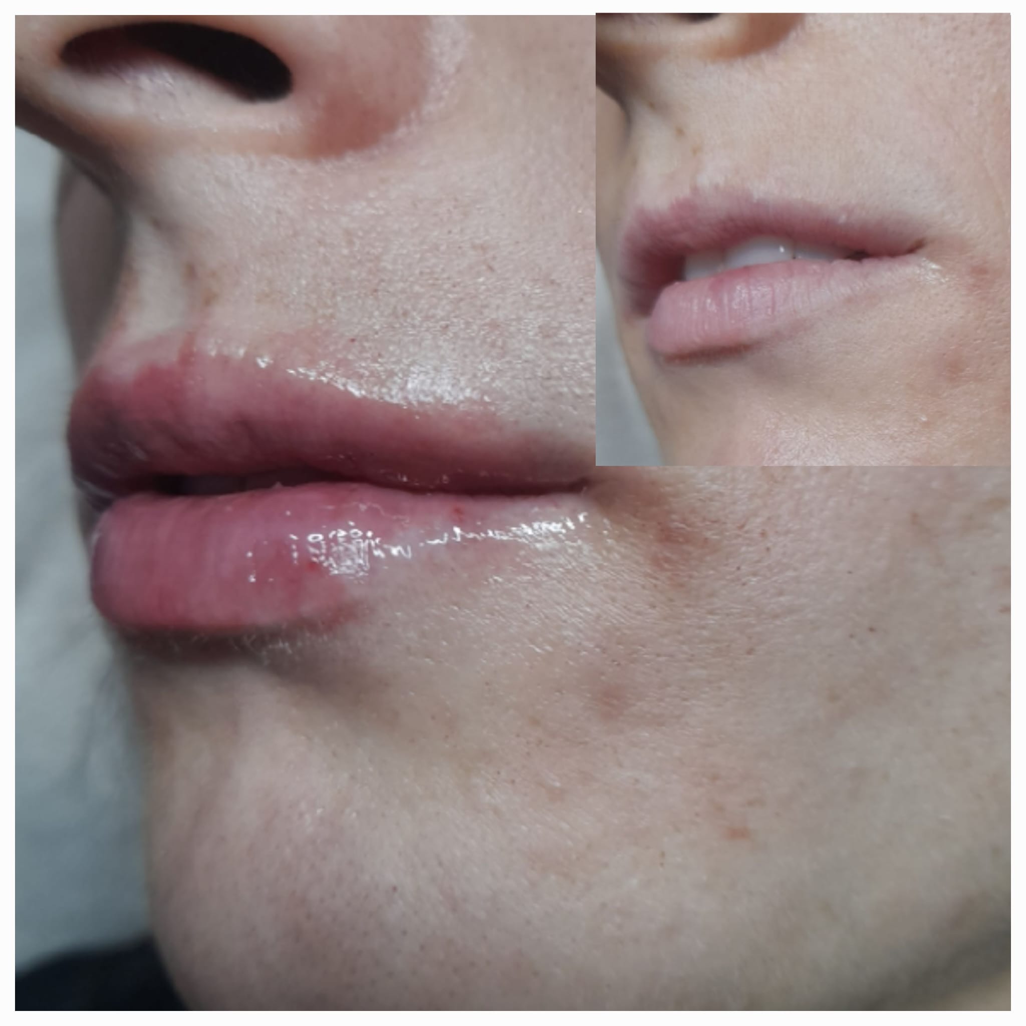 Medicina Estética