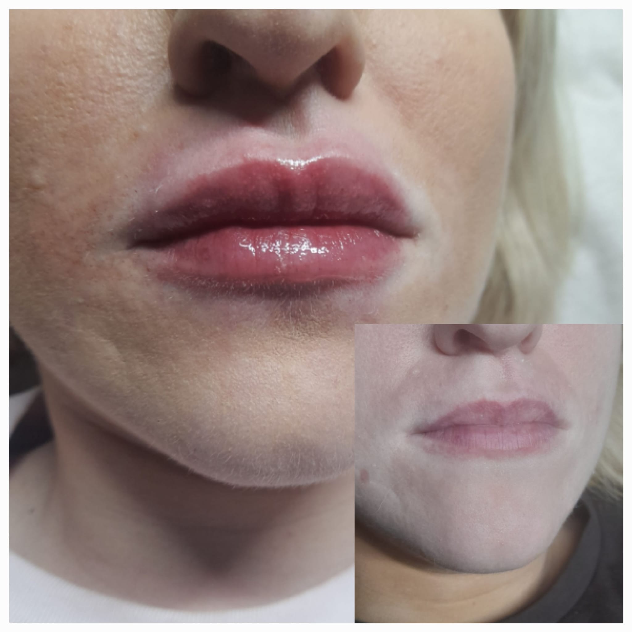 Medicina Estética
