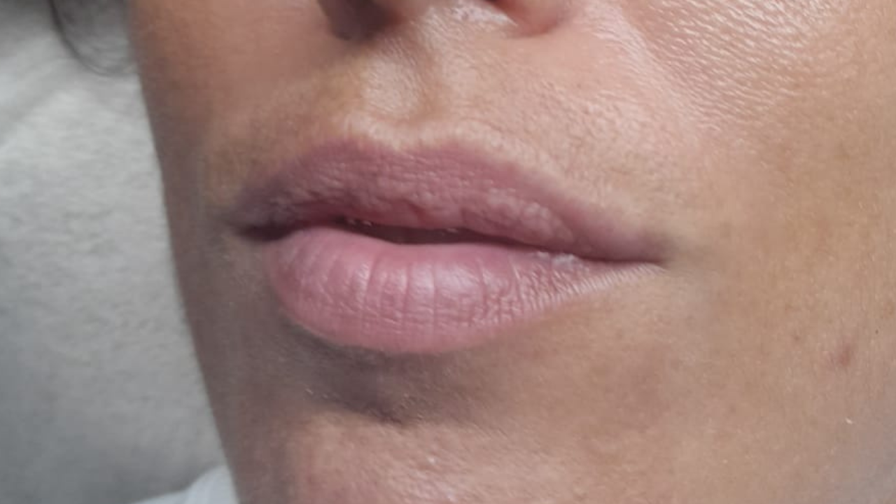 Antes