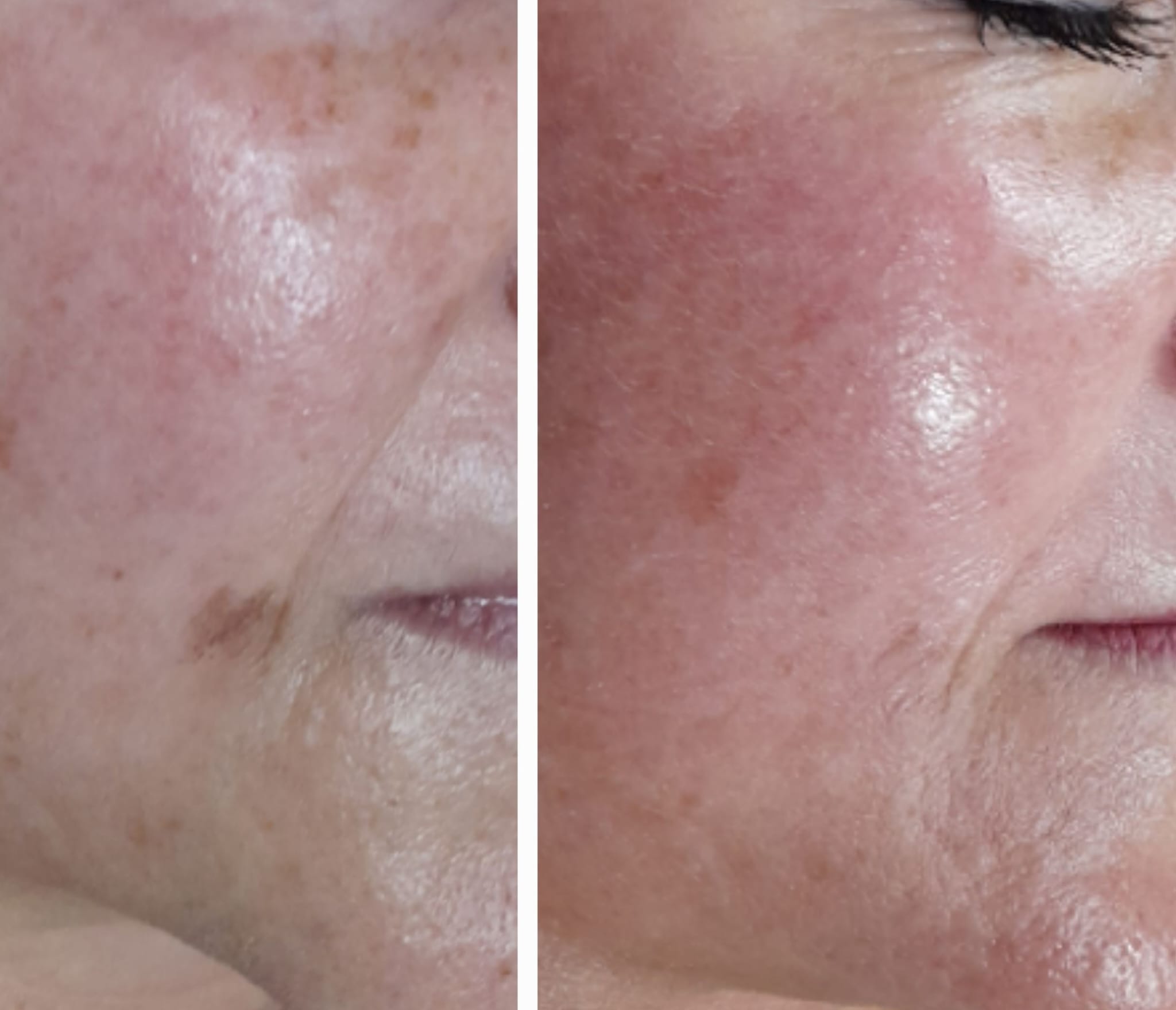 Estética Facial